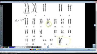 Karyotype analysis [upl. by Enitsuga564]