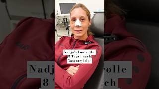 Nadja’s Kontrolle 8 Tage nach Nasenrevision 👃🏻🩺 drberkei plasticsurgery nasenop [upl. by Maudie]