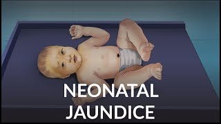 Neonatal Jaundice by L Veit  OPENPediatrics [upl. by Mathi]