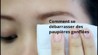 Comment se débarrasser des paupières gonflées [upl. by Acirrehs84]