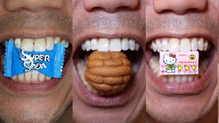 Satisfying Candy and Chocolate Chewing ASMR Sounds Doctor Tristan Peh [upl. by Quartas194]