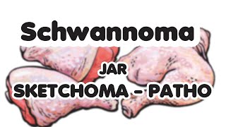 16 Sketchoma  عملي باثولوجي  pathology CNS  Schwannoma Jar [upl. by Nyladnarb]