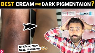 Best SKIN CREAM for DARK Pigmentation  Cuticans Cream amp Kozimax Cream Review QualityMantra [upl. by Ahselaf719]