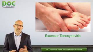 What Should a Runner do to Help Extensor Tenosynovitis [upl. by Atrice]