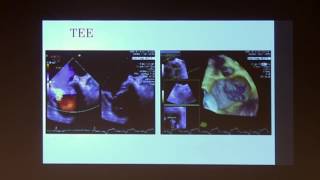 Illustrative Case Presentations 2  2017 UCLA ACHD Symposium [upl. by Onofredo587]