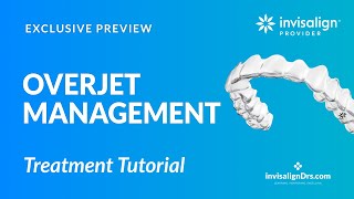 Overjet Management with Invisalign [upl. by Hofmann]