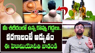 మీశరీరంలో ఉన్న కొవ్వుగడ్డలు కరగాలంటే అద్భుతం ఈహోమియోపతి వాడండిkovvu gaddaluhomeopathyhittvhealth [upl. by Mychal]