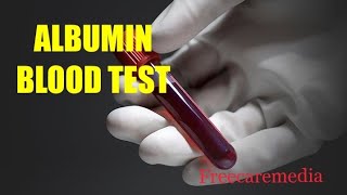 Albumin test malayalam  Albumin test albumintest medicallaboratorytechnician [upl. by Moia]