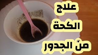 وصفة علاج الكحة في ساعة انشاءالله 3ilaj koha [upl. by Benoit]