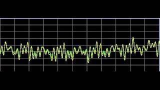 Nervous System Disorders  Rife Frequencies [upl. by Fernandina]