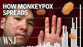 Why Monkeypox Is a Global Health Threat  WSJ [upl. by Burford]