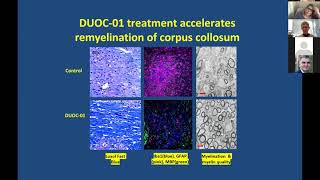 Wednesday July 22 2020  DUOC for Leukodystrophies [upl. by Akinert117]