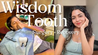 Wisdom tooth removal surgery  recovery and sharing my experience  Hansika Krishna [upl. by Abbott]