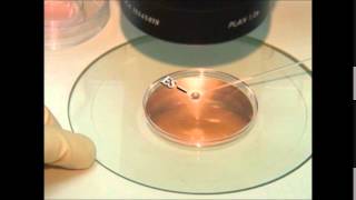 vitrification of embryos and oocytes [upl. by Harsho]