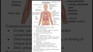 Signs and symptoms of anaphylaxis [upl. by Hoffert625]