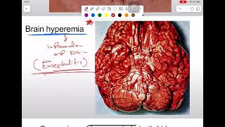 General pathology lab  Hemodynamics disorders part 1 [upl. by Nelle]