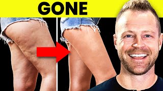 Get Rid Of CELLULITE Following This Simple Routine Naturally [upl. by Timus]