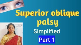 Superior Oblique palsy Trochlear nerve palsy Parks Bielschowsky testCauses Clinical features [upl. by Farrah]