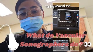 Day in the Life of a Vascular Technologist in an Outpatient Facility  Im TIRED [upl. by Niawd156]