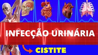 CISTITE  INFECÇÃO URINÁRIA  SINTOMAS DIAGNÓSTICO E TRATAMENTO  INFECÇÃO DA BEXIGA  TRATAMENTO [upl. by Elda847]