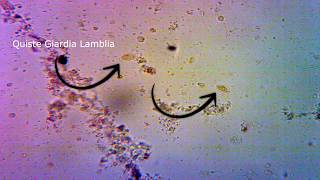 Blastocystis hominis y Giardia lamblia 1  Quistes  Microscope 40x Lugol Copro  Pura Ciencia [upl. by Horsey972]