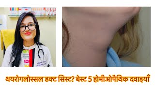 थयरोगलोस्सल डक्ट सिस्टThyroid Glossal Duct Cyst Homeopathic Medicine Thyroglossal Cyst Treatment [upl. by Alexio127]