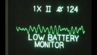 ACLS Algorithms  Ventricular Fibrillation  Sacramento Class [upl. by Janine]