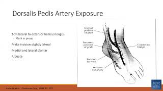 quotDorsalis Pedis Artery Exposure  How I Do Itquot [upl. by Harahs262]