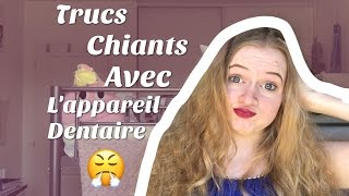 LES TRUCS CHIANTS AVEC LAPPAREIL DENTAIRE [upl. by Roskes906]