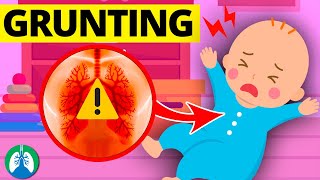 Infant Grunting Respiratory Distress  Medical Overview [upl. by Atwekk]