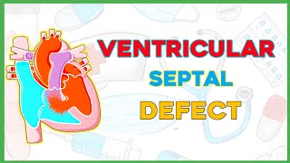 Ventricular Septal Defect VSD Pathophysiology clinical features diagnosis treatmentpediatrics [upl. by Sinegold]