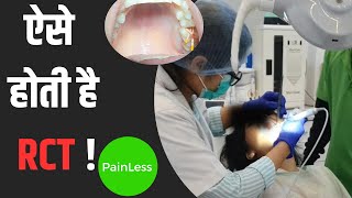 Root canal treatment कैसे किया जाता है  RCT  RCT TREATMENT  DR GULS DENTAL CLINIC NOIDA [upl. by Sillig433]