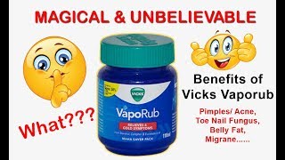 Amazing Benefits of Vicks Vaporub  Cures Pimples amp Acne Reduces Belly Fat amp Much More [upl. by Brigette]