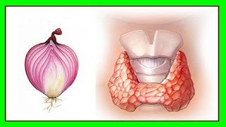 El Cáncer De Tiroides Es Muy Peligroso Estos Son Los 4 Primeros Síntomas Que No Debes Ignorar [upl. by Aicileb]