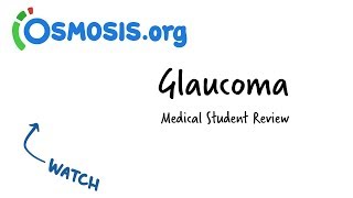 Glaucoma  Clinical Presentation [upl. by Ahsiema]