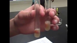 Catalase Enzyme Lab Test 4  Part I Mr Pauller [upl. by Saucy]