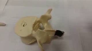 Typical Vertebra Parts 1 of 2 [upl. by Ciryl]