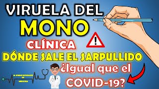 VIRUELA DEL MONO Clínica  ¿Dónde puede salir el sarpullido  El Eterno Estudiante de Medicina [upl. by Robby348]