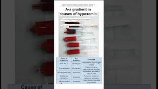 Aa gradient hypoxemia [upl. by Launce]