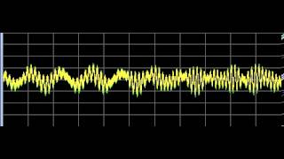 Hypertension High Blood Pressure  Rife Frequencies [upl. by Zosema692]