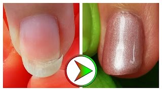 extrem eingebrochenen Nagel retten  Tutorial Nagelreparatur amp Reinigung [upl. by Romola]