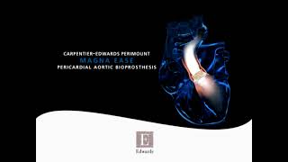 CarpentierEdwards PERIMOUNT Magna Ease aortic valve [upl. by Hess]