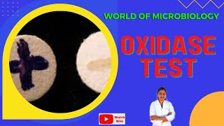 Oxidase Test Tamil  Cytochrome Oxidase  Identification of Bacteria by Biochemical Test [upl. by Danuloff]