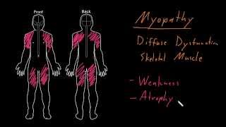 Syndrome Myopathy [upl. by Aleahc]