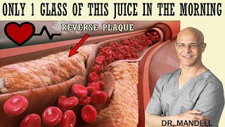 1 GLASS OF THIS JUICE IN THE MORNINGREVERSE CLOGGED ARTERIES amp LOWER HIGH BLOOD PRESSURE [upl. by Drannel]