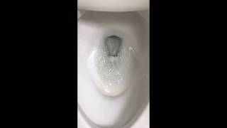 Unclog Toilet Bowl Siphon Jet Hole to Improve Flushing [upl. by Kessia359]