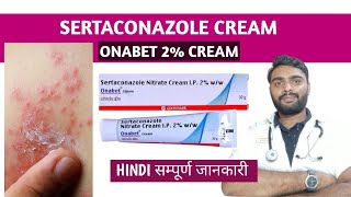 Sertaconazole cream in hindi  Onabet cream  Sertaconazole ointment [upl. by Havelock]