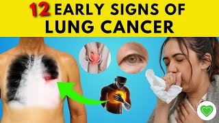 Spotting Lung Cancer Early 12 Warning Signs You Should Know  Lung Cancer Symptoms [upl. by Ernesta]