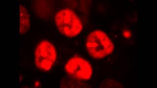 Recruitment of 53BP1 to DNA double strand breaks sites [upl. by Acenahs838]