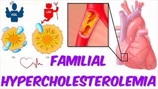 Familial Hypercholesterolemia High Cholesterol Levels [upl. by Struve]